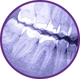 Рентгенологическое обследование зубов